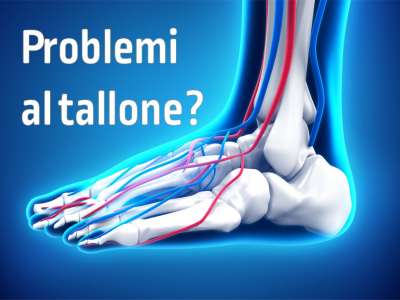 TALLONITE: PREVENZIONE E CURA